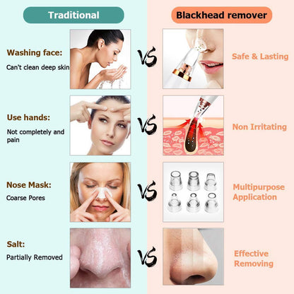 Multi-Function Blackhead Remover